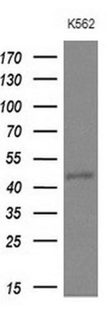NUP43 Antibody in Western Blot (WB)