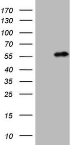 NUP43 Antibody in Western Blot (WB)