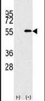NUP50 Antibody in Western Blot (WB)