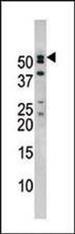 NUP50 Antibody in Western Blot (WB)