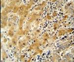 NUSAP1 Antibody in Immunohistochemistry (IHC)