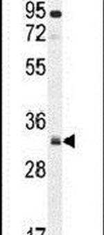 NUSAP1 Antibody in Western Blot (WB)