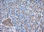 NXNL2 Antibody in Immunohistochemistry (Paraffin) (IHC (P))