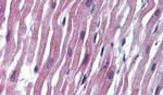 SCN5A Antibody in Immunohistochemistry (Paraffin) (IHC (P))