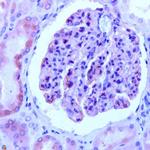 Nephrin Antibody in Immunohistochemistry (IHC)
