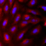 Nestin Monoclonal Antibody (10C2), Alexa Fluor™ 555