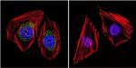 NF1 Antibody in Immunocytochemistry (ICC/IF)