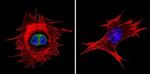 NF1 Antibody in Immunocytochemistry (ICC/IF)