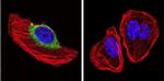 NF1 Antibody in Immunocytochemistry (ICC/IF)