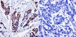 NF1 Antibody in Immunohistochemistry (Paraffin) (IHC (P))