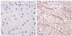 NEFM Antibody in Immunohistochemistry (Paraffin) (IHC (P))