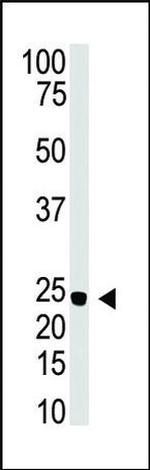 NeuroG3 Antibody in Western Blot (WB)