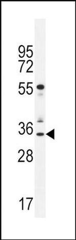 NeuroG3 Antibody in Western Blot (WB)