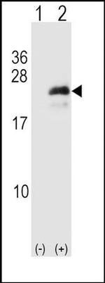 NeuroG3 Antibody in Western Blot (WB)