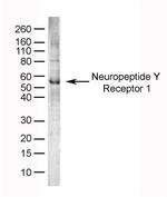 NPY1R Polyclonal Antibody