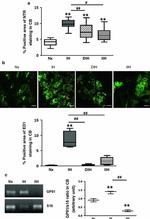 Nitrotyrosine Antibody in Immunohistochemistry (Paraffin) (IHC (P))