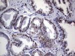 NKX3.1 Antibody in Immunohistochemistry (Paraffin) (IHC (P))