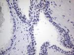 NKX3.1 Antibody in Immunohistochemistry (Paraffin) (IHC (P))