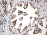 NKX3.1 Antibody in Immunohistochemistry (Paraffin) (IHC (P))