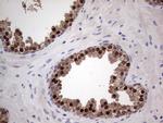 NKX3.1 Antibody in Immunohistochemistry (Paraffin) (IHC (P))