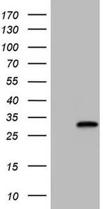 NKX3.1 Antibody in Western Blot (WB)