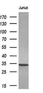 NKX3.1 Antibody in Western Blot (WB)