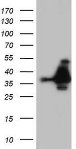 NKX3.1 Antibody in Western Blot (WB)