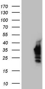 Nkx3.1 Antibody in Western Blot (WB)