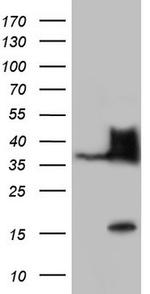 NKX3.1 Antibody in Western Blot (WB)