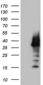 Nkx3.1 Antibody in Western Blot (WB)