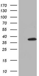 Nkx3.1 Antibody in Western Blot (WB)