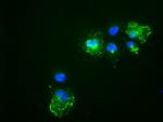 Noggin Antibody in Immunocytochemistry (ICC/IF)