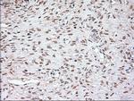 Noggin Antibody in Immunohistochemistry (Paraffin) (IHC (P))