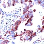 S6 Antibody in Immunohistochemistry (IHC)