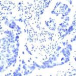S6 Antibody in Immunohistochemistry (IHC)