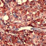 S6 Antibody in Immunohistochemistry (IHC)