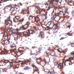 ErbB2 (HER-2) Antibody in Immunohistochemistry (IHC)
