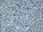 Notch1 Antibody in Immunohistochemistry (Paraffin) (IHC (P))