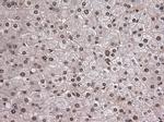 Notch1 Antibody in Immunohistochemistry (Paraffin) (IHC (P))