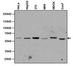 NUP62 Monoclonal Antibody (RL31)