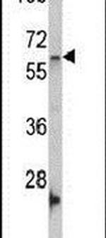 Nucleostemin Antibody in Western Blot (WB)