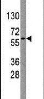 Nucleostemin Antibody in Western Blot (WB)