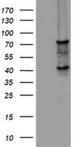 OAS2 Antibody in Western Blot (WB)