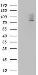 OAS2 Antibody in Western Blot (WB)