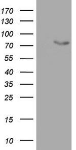 OAS2 Antibody in Western Blot (WB)