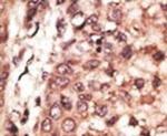 CREB3L1 Antibody in Immunohistochemistry (IHC)