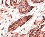 OASL Antibody in Immunohistochemistry (IHC)