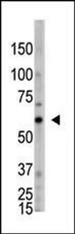 OASL Antibody in Western Blot (WB)