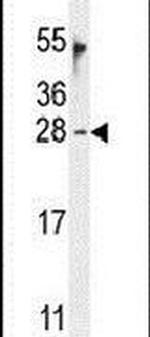 OAZ2 Antibody in Western Blot (WB)