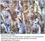 OCSTAMP Antibody in Immunohistochemistry (IHC)
